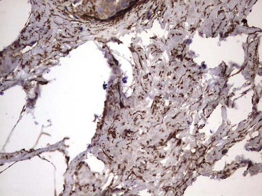 IHC of paraffin-embedded Human breast tissue using anti-IL1RN mouse monoclonal antibody. (Heat-induced epitope retrieval by 1 mM EDTA in 10mM Tris, pH8.5, 120°C for 3min).