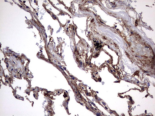 IHC of paraffin-embedded Human lung tissue using anti-IL1RN mouse monoclonal antibody. (Heat-induced epitope retrieval by 1 mM EDTA in 10mM Tris, pH8.5, 120°C for 3min).