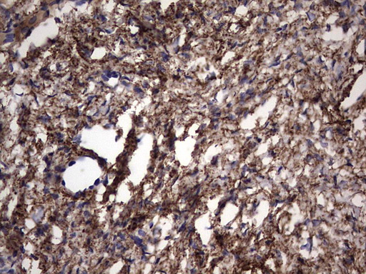 IHC of paraffin-embedded Human Ovary tissue using anti-IL1RN mouse monoclonal antibody. (Heat-induced epitope retrieval by 1 mM EDTA in 10mM Tris, pH8.5, 120°C for 3min).