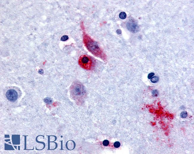 Anti-GPR61 antibody LS-A6708 IHC of human brain, caudate. Immunohistochemistry of formalin-fixed, paraffin-embedded tissue after heat-induced antigen retrieval.