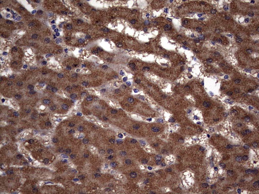 IHC of paraffin-embedded Human liver tissue using anti-IL1RN mouse monoclonal antibody. (Heat-induced epitope retrieval by 1 mM EDTA in 10mM Tris, pH8.5, 120°C for 3min).