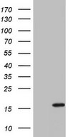 HEK293T cells were transfected with the pCMV6-ENTRY control (Left lane) or pCMV6-ENTRY IL1RN (Right lane) cDNA for 48 hrs and lysed. Equivalent amounts of cell lysates (5 ug per lane) were separated by SDS-PAGE and immunoblotted with anti-IL1RN.