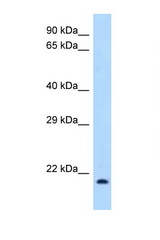 IL1RN / IL-1RA antibody LS-C146126 Western blot of 293T Cell lysate. Antibody concentration 1 ug/ml.