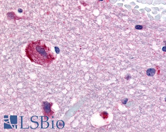 Anti-GPR61 antibody LS-A6716 IHC of human brain, caudate. Immunohistochemistry of formalin-fixed, paraffin-embedded tissue after heat-induced antigen retrieval.