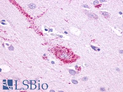 Anti-GPR61 antibody LS-A1685 IHC of human brain, neurons and glia. Immunohistochemistry of formalin-fixed, paraffin-embedded tissue after heat-induced antigen retrieval.