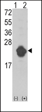 Western blot of IL1RN (arrow) using rabbit polyclonal IL1RN Antibody. 293 cell lysates (2 ug/lane) either nontransfected (Lane 1) or transiently transfected with the IL1RN gene (Lane 2) (Origene Technologies).