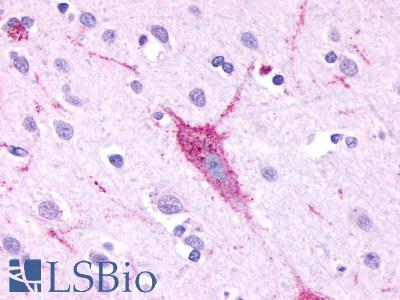 Anti-GPR61 antibody LS-A1689 IHC of human brain, neurons and glia. Immunohistochemistry of formalin-fixed, paraffin-embedded tissue after heat-induced antigen retrieval.