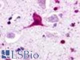 Anti-GPR62 antibody LS-A510 IHC of human brain, neurons and glia. Immunohistochemistry of formalin-fixed, paraffin-embedded tissue after heat-induced antigen retrieval.