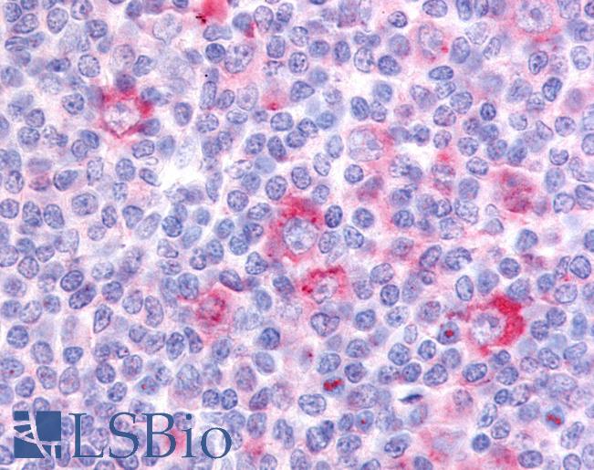 Anti-GPR62 antibody LS-A3548 IHC of human tonsil. Immunohistochemistry of formalin-fixed, paraffin-embedded tissue after heat-induced antigen retrieval.