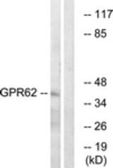 Western blot of extracts from COLO cells, using GPR62 Antibody. The lane on the right is treated with the synthesized peptide.
