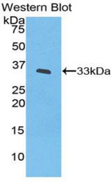 Western blot of recombinant IL20RB.