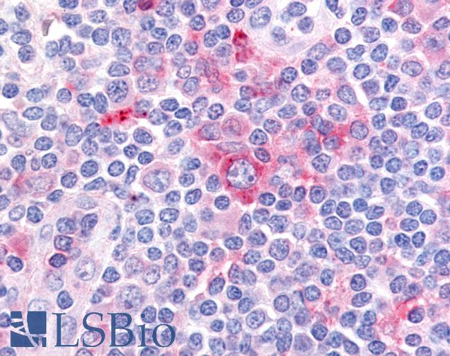 Anti-GPR62 antibody LS-A3646 IHC of human tonsil. Immunohistochemistry of formalin-fixed, paraffin-embedded tissue after heat-induced antigen retrieval.