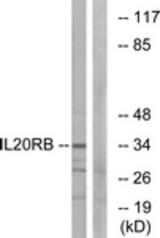 Western blot of extracts from HeLa cells, using IL20RB Antibody. The lane on the right is treated with the synthesized peptide.