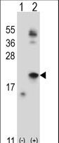 Western blot of IL21 (arrow) using rabbit polyclonal IL21 Antibody. 293 cell lysates (2 ug/lane) either nontransfected (Lane 1) or transiently transfected (Lane 2) with the IL21 gene.