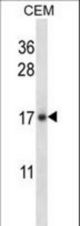 IL21 Antibody western blot of CEM cell line lysates (35 ug/lane). The IL21 antibody detected the IL21 protein (arrow).