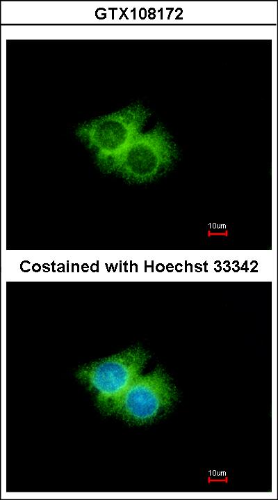 Immunofluorescence of methanol-fixed Hep G2 using GPR62 antibody at 1:500 dilution.