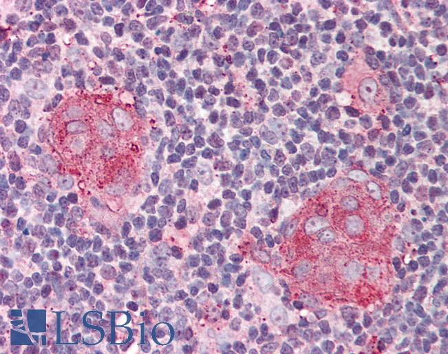 Anti-IL21 Receptor antibody IHC of human thymus. Immunohistochemistry of formalin-fixed, paraffin-embedded tissue after heat-induced antigen retrieval. Antibody LS-B572 concentration 5 ug/ml.