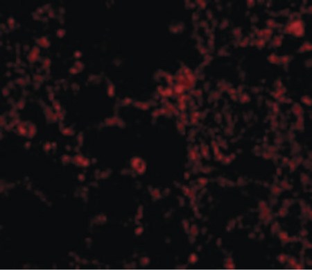 Immunofluorescence of IL-21 Receptor in Rat Lung cells with IL-21 Receptor antibody at 20 ug/ml.