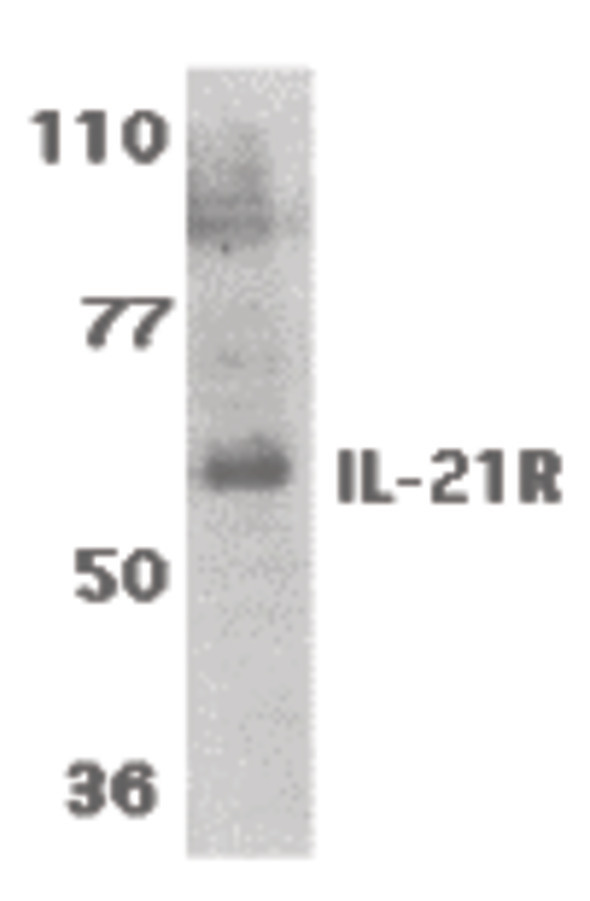 Western blot of IL-21 receptor expression in human Raji cell lysate with IL-21 Receptor antibody at 1 ug /ml.