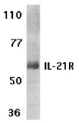 Western blot of IL-21R expression in human Raji cell lysate with IL-21R antibody at 1 ug /ml.