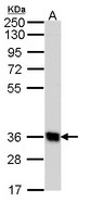 Sample (30 ug of whole cell lysate). A: Hep G2 . 10% SDS PAGE. GPR62 antibody diluted at 1:1000.