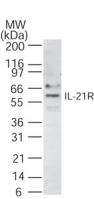 Western blot of IL-21R in 30 ugs of Raji cell lysate using antibody at 1 ug/ml.