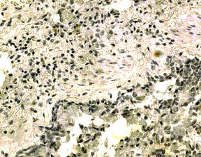 Immunohistochemistry of paraffin-embedded human lung with Goat anti-human interleukin-21 receptor (N-terminal)