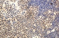 IHC of IL-22 antibody LS-C83972. Formalin-fixed, paraffin-embedded human tonsil.