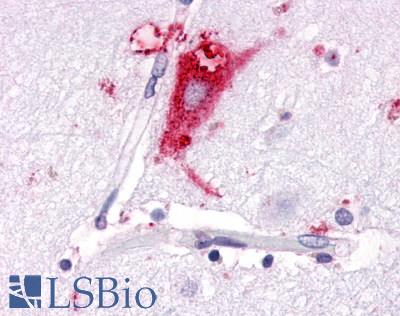 Anti-GPR63 antibody LS-A6379 IHC of human brain, neurons and glia. Immunohistochemistry of formalin-fixed, paraffin-embedded tissue after heat-induced antigen retrieval.