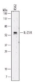 Western blot shows lysates of K562 human chronic myelogenous leukemia cell line. PVDF membrane was probed with 2 ug/mL of LS-C37068 followed by HRP conjugated Anti Mouse IgG Secondary Antibody. A specific band was detected for IL 23 R at approximately 58 kD (as indicated). This experiment was conducted under non reducing conditions.