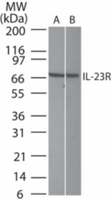 Western blot of IL-23R in (A) Jurkat and (B) NIH3T3 cell lysate using antibody at 0.5 ug/ml.