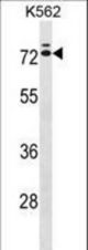 IL23R Antibody western blot of K562 cell line lysates (35 ug/lane). The IL23R antibody detected the IL23R protein (arrow).