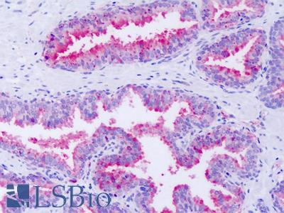 Anti-GPR63 antibody IHC of human prostate. Immunohistochemistry of formalin-fixed, paraffin-embedded tissue after heat-induced antigen retrieval. Antibody LS-A6352 dilution 13 ug/ml.
