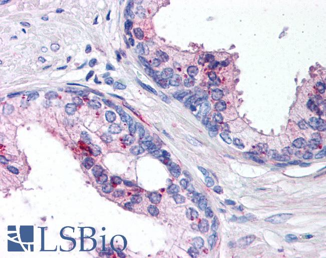 Anti-IL-24 antibody IHC of human prostate. Immunohistochemistry of formalin-fixed, paraffin-embedded tissue after heat-induced antigen retrieval. Antibody LS-B113 concentration 10 ug/ml.