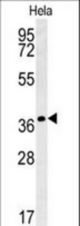 IL24 Antibody western blot of HeLa cell line lysates (35 ug/lane). The IL24 antibody detected the IL24 protein (arrow).