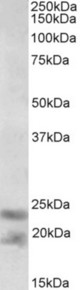 IL25 antibody (0.3 ug/ml) staining of Human Prostate lysate (35 ug protein in RIPA buffer). Primary incubation was 1 hour. Detected by chemiluminescence.