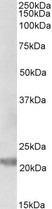 IL25 antibody (0.5 ug/ml) staining of Human Prostate lysate (35 ug protein in RIPA buffer). Primary incubation was 1 hour. Detected by chemiluminescence.