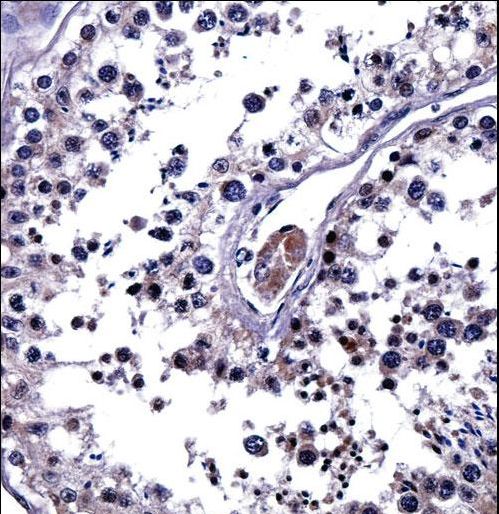IL25 Antibody immunohistochemistry of formalin-fixed and paraffin-embedded human testis tissue followed by peroxidase-conjugated secondary antibody and DAB staining.