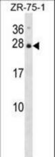 IL25 Antibody western blot of ZR-75-1 cell line lysates (35 ug/lane). The IL25 antibody detected the IL25 protein (arrow).