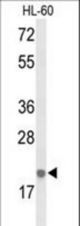 Western blot of IL26 Antibody in HL-60 cell line lysates (35 ug/lane). IL26 (arrow) was detected using the purified antibody.