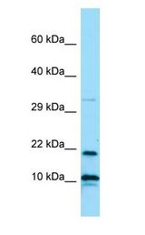 IL26 / IL-26 antibody Western Blot of ACHN.