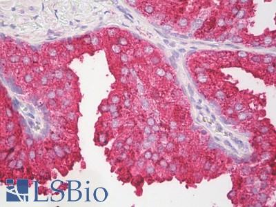 Anti-IL-27 antibody IHC of human prostate. Immunohistochemistry of formalin-fixed, paraffin-embedded tissue after heat-induced antigen retrieval. Antibody LS-B8257 dilution 5-10 ug/ml.