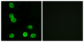Immunofluorescence of MCF7 cells, using GPR63 Antibody. The picture on the right is treated with the synthesized peptide.