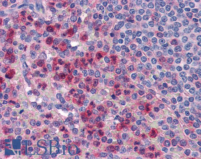 Anti-IL-27 antibody IHC of human spleen, neutrophils. Immunohistochemistry of formalin-fixed, paraffin-embedded tissue after heat-induced antigen retrieval. Antibody LS-B2719 concentration 5 ug/ml.