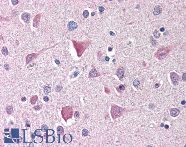 Anti-IL27RA antibody IHC of human brain, cortex. Immunohistochemistry of formalin-fixed, paraffin-embedded tissue after heat-induced antigen retrieval. Antibody LS-B574 concentration 5 ug/ml.