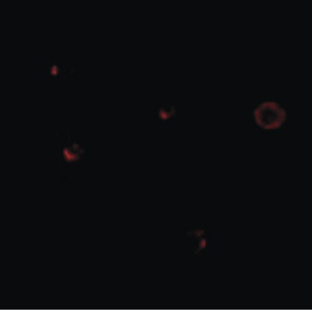 Immunofluorescence of TCCR in A549 cells with TCCR antibody at 20 ug/ml.