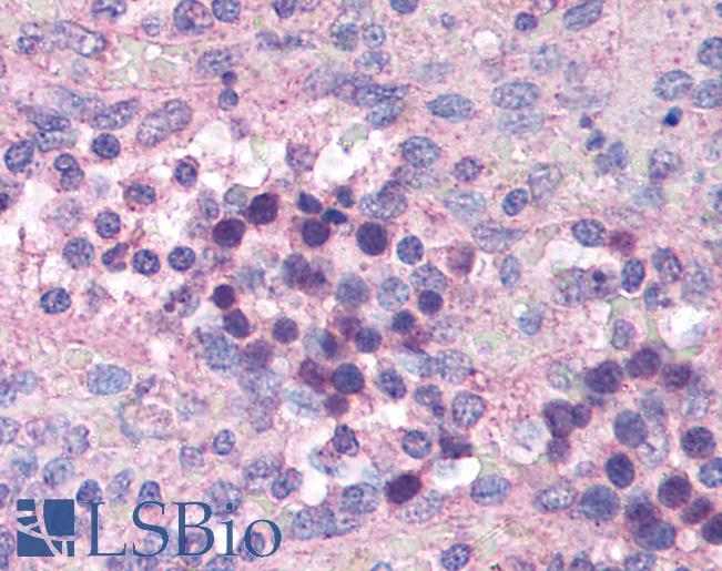 Anti-IL27RA antibody IHC of human spleen. Immunohistochemistry of formalin-fixed, paraffin-embedded tissue after heat-induced antigen retrieval. Antibody LS-B1367 concentration 5 ug/ml.