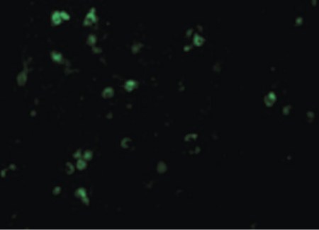 Immunofluorescence of TCCR in Human Spleen cells with TCCR antibody at 20 ug/ml.