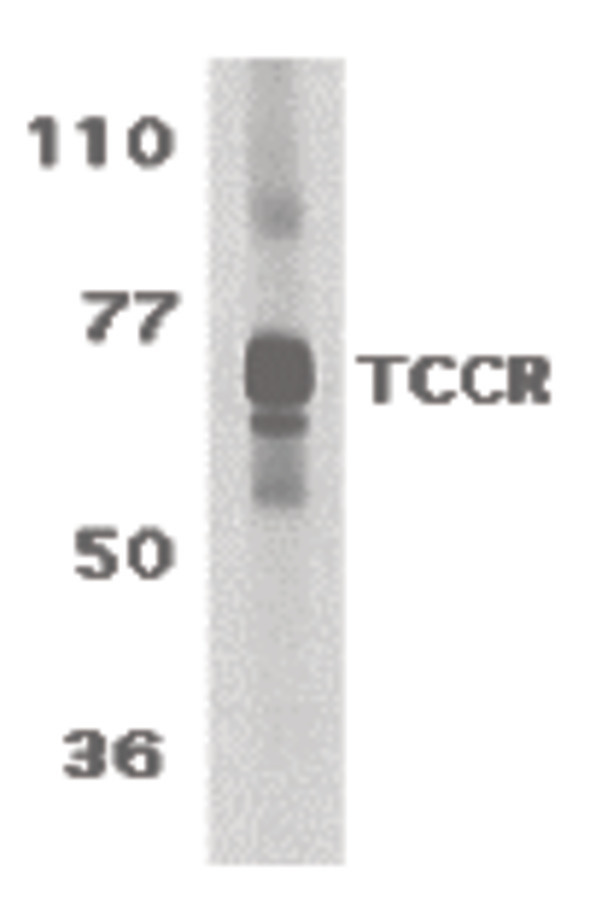 Western blot of TCCR expression in human spleen tissue lysate with TCCR antibody at 1 ug /ml.