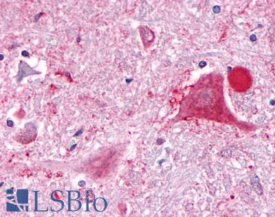 Anti-GPR63 antibody LS-A1724 IHC of human brain, neurons and glia. Immunohistochemistry of formalin-fixed, paraffin-embedded tissue after heat-induced antigen retrieval.